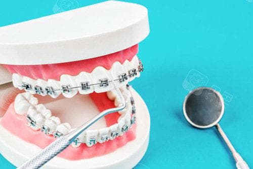 牙齿稀疏牙缝大怎么矫正？不同情况方法不同，可正畸|牙齿贴面修复等