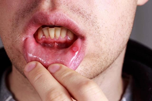 紧急关注！上海推出HIV快速响应机制：72小时核酸检测守护健康防线